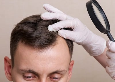 Diagnostik bei Haarausfall: Welche Spezialisten und Untersuchungen stehen zur Auswahl?