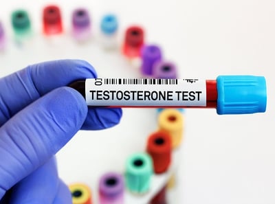 Blutprobe für Testosteron-Test