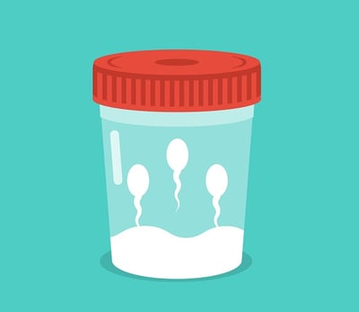 Spermaprobe in einem Glasröhrchen
