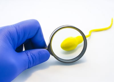 Arzt betrachtet Spermazelle durch ein Vergrößerungsglas