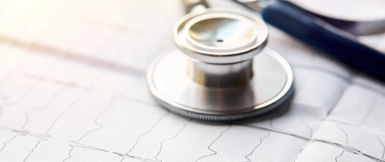 Stethoskop auf einem EKG-Ausdruck in Nahaufnahme