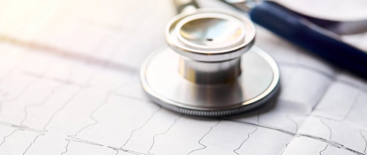 Et stetoskop placeret p&aring; en EKG-rapport