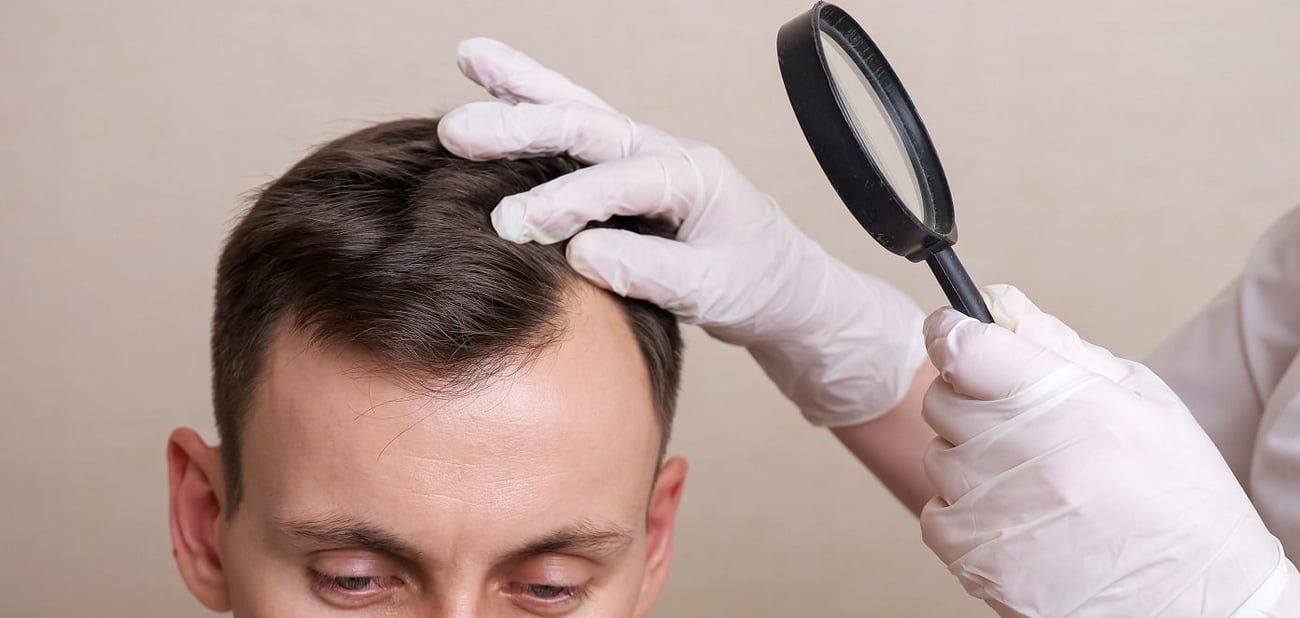 Ein Mediziner untersucht mit einer Lupe die Kopfhaut eines jungen Mannes.