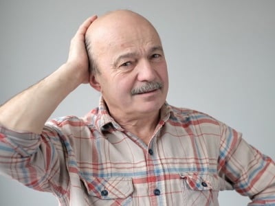 Ein älterer Mann mit fortgeschrittener Glatze.