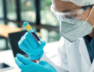 Ein Forscher führt im Labor eine Analyse von Blutproben eines Patienten durch.