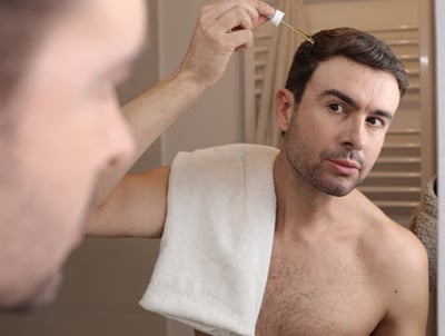 Ein Mann, der Minoxidil-Tropfen gegen Haarausfall aufträgt