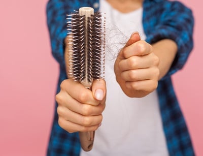 Ein Mädchen mit ungesundem, geschädigtem Haar auf einer Bürste, das an Haarausfall durch Schuppenbildung leidet