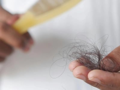 Ausgefallene Haare in der Hand vor einer Haarbürste