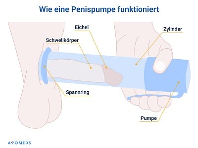  Ein Vektorbild der Funktion einer Penispumpe.