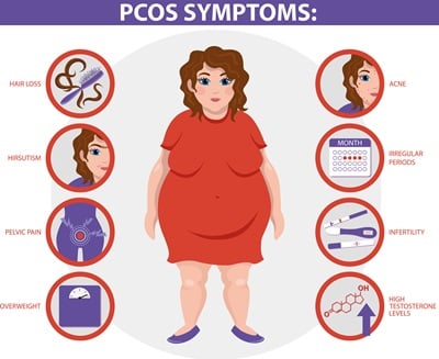 Infografik zu PCOS-Symptomen