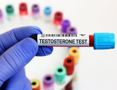 Ein Labortest auf Testosteron