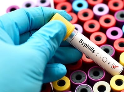 Bluttest für Syphilis