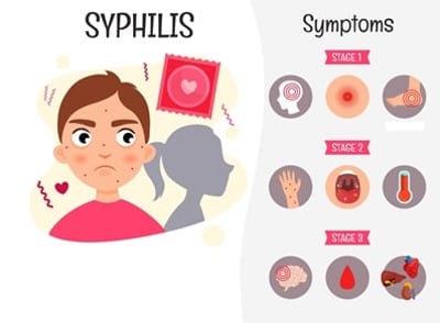 Die Symptome der Syphilis in verschiedenen Stadien