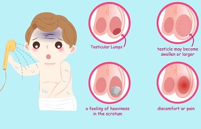 Vektorbild av en man med symptom på testikelcancer