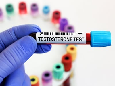 Laborteströhrchen mit Bluttest für Testosteron