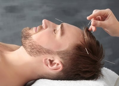 Ein Mann in der Akupunkturbehandlung