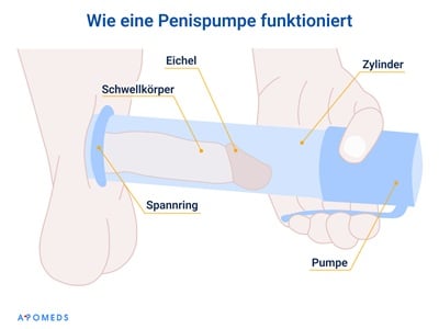 So funktioniert eine Penispumpe
