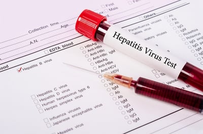 Blutprobe zum Nachweis des Hepatitis-B-Virus als Vorsorgeuntersuchung